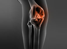 Knee Cartilage Restoration