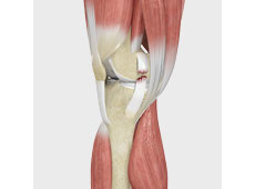 Knee Sports Injuries